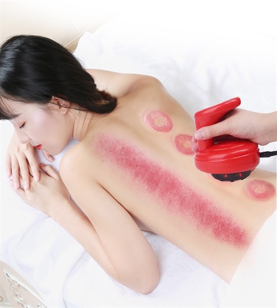 Máy giác hơi massage điện tử